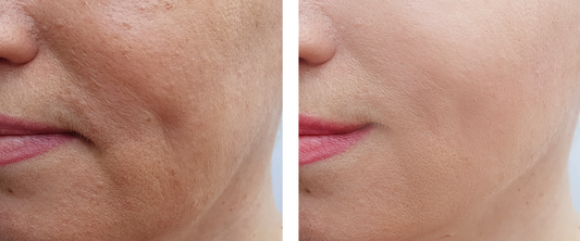 How Lucky Skin Hydro Transformed My Skincare Routine: Real Stories from Real Customers